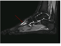 MRI&CT Foot